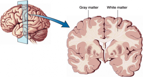 Diagrama del cerebro