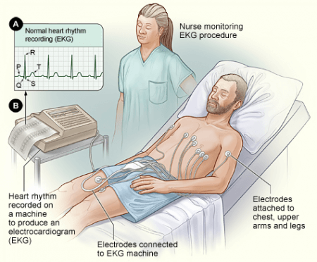 electrocardiograma