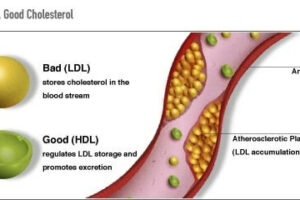 Diferencia entre Colesterol HDL y LDL